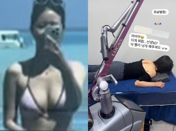Park Hana Suffers Burn Injury Ahead of Wedding